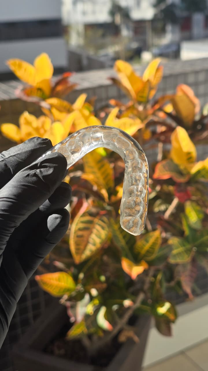 Placa miorrelaxante transparente com as marcas dos dentes